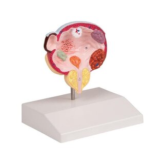 Anatomisk model for prostata