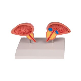 Prostata model, 2-delt