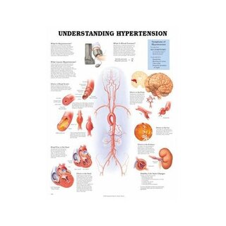 Understanding High Blood Pressure Lamineret plakat 51x66 cm