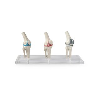 Knæimplantat model