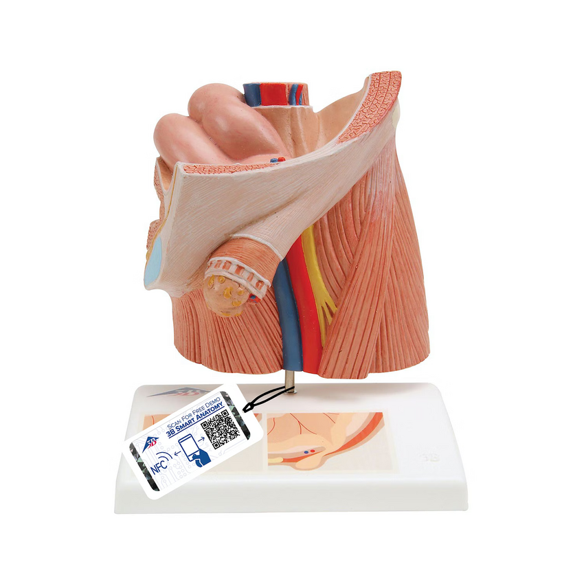 Lyskebrok urologisk model