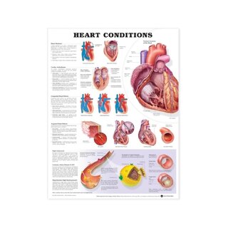 Hjertesituation lamineret plakat
