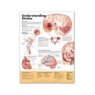 Understanding Stroke engelsk lamineret (understanding Stroke)
