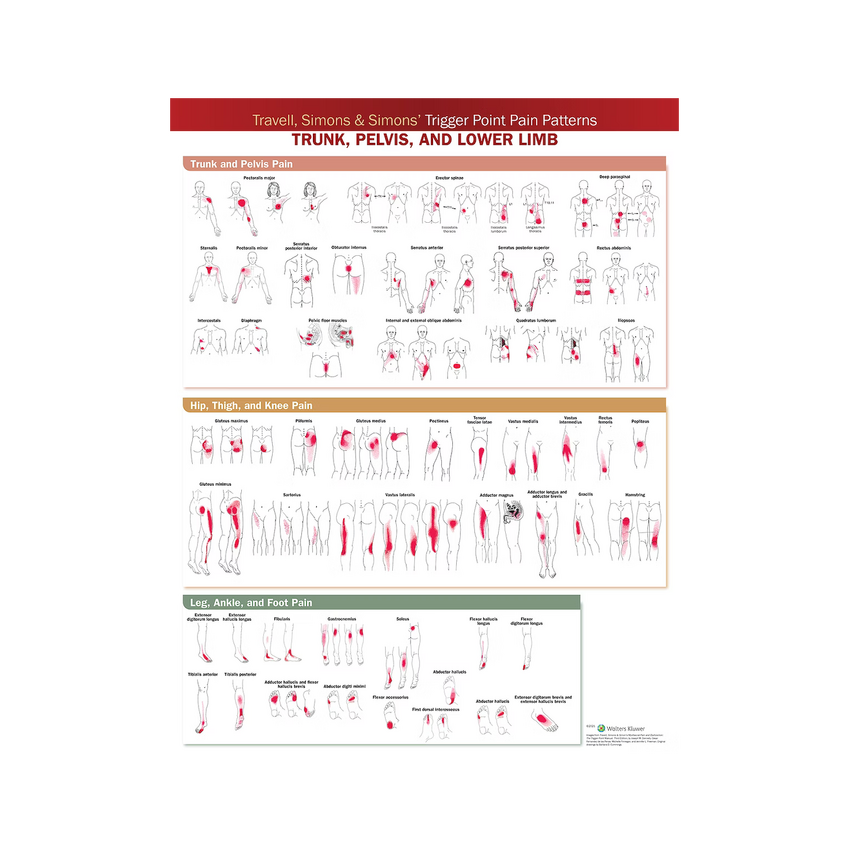 Trigger point plakat udviklet af Travell & Simons