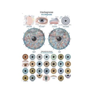 Diagram Iris diagnose anatomi plakat 50x70cm