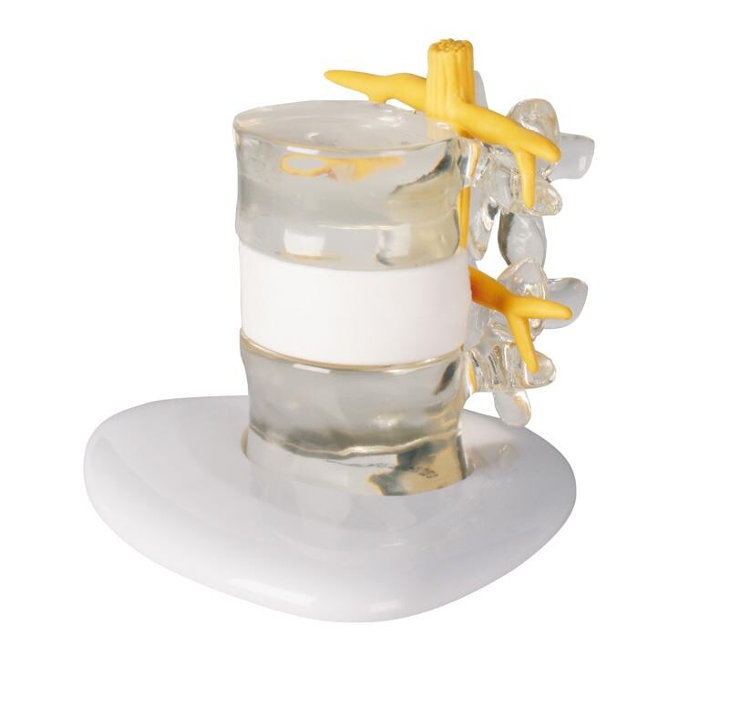 Diskusprolaps simulator